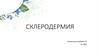 Склеродермия