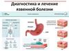 Диагностика и лечение язвенной болезни