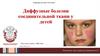 Диффузные болезни соединительной ткани у детей