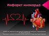 Инфаркт миокарда