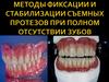 Методы фиксации и стабилизации съемных протезов при полном отсутствии зубов
