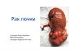 Онкоурология. Рак почки