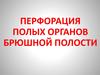 Перфорация полых органов брюшной полости
