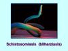 Schistosomiasis (bilharziasis)