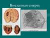 Внезапная смерть