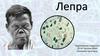 Лепра