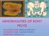 Abnormalities of bony pelvis
