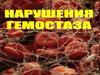 Нарушения гемостаза