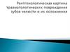 Рентгенологическая картина травматологических повреждения зубов челюсти и их осложнения