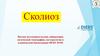 Сколиоз