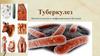 Туберкулез. Эпизоотология и инфекционные болезни