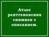 Атлас рентгеновских снимков с описанием