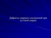 Дефекты сварных соединений при дуговой сварке