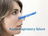 Acute respiratory failure