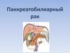 Панкреатобилиарный рак
