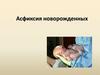 Асфиксия новорождённых