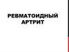 Ревматоидный артрит