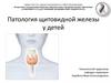 Патология щитовидной железы
