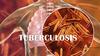 Tuberculosis. What is tuberculosis?