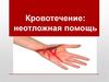 Кровотечение: неотложная помощь