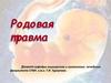 Родовая травма