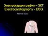 Электрокардиография – ЭКГ Electrocardiography - ECG