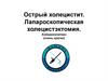 Острый холецистит. Лапароскопическая холецистэктомия. Холедохолитиаз