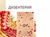 Инфекционная болезнь дизентерия