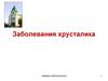Заболевания хрусталика. Лекция 6