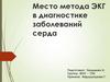 Место метода ЭКГ в диагностике заболеваний серда