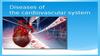 Diseases of the cardiovascular system
