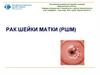 Рак шейки матки. Лекция 20