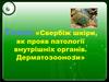 Свербіж шкіри, як прояв патології внутрішніх органів. Дерматозоонози