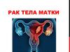 Рак тела матки