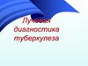 Лучевая диагностика туберкулеза
