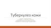 Туберкулез кожи