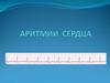 Аритмии сердца