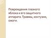 Повреждения глазного яблока и его защитного аппарата. Травмы, контузии, ожоги