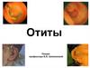 Заболевания уха